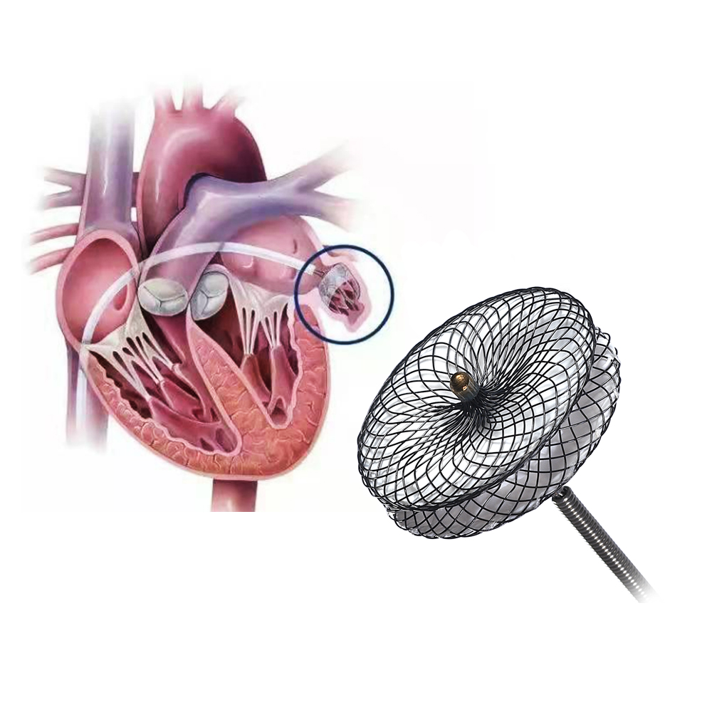 Medical-grade superelastic Nitinol wire